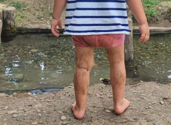 Bambina di spalle con le gambe sporche di fango davanti a una pozza d’acqua